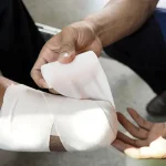 Prosedur Medis Amputasi Pada Bagian Anggota Tubuh